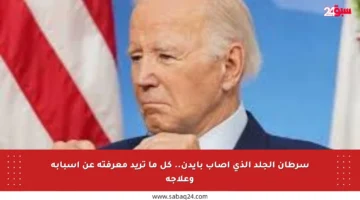 سرطان الجلد الذي أصاب بايدن.. كل ما تريد معرفته عن أسبابه وعلاجه